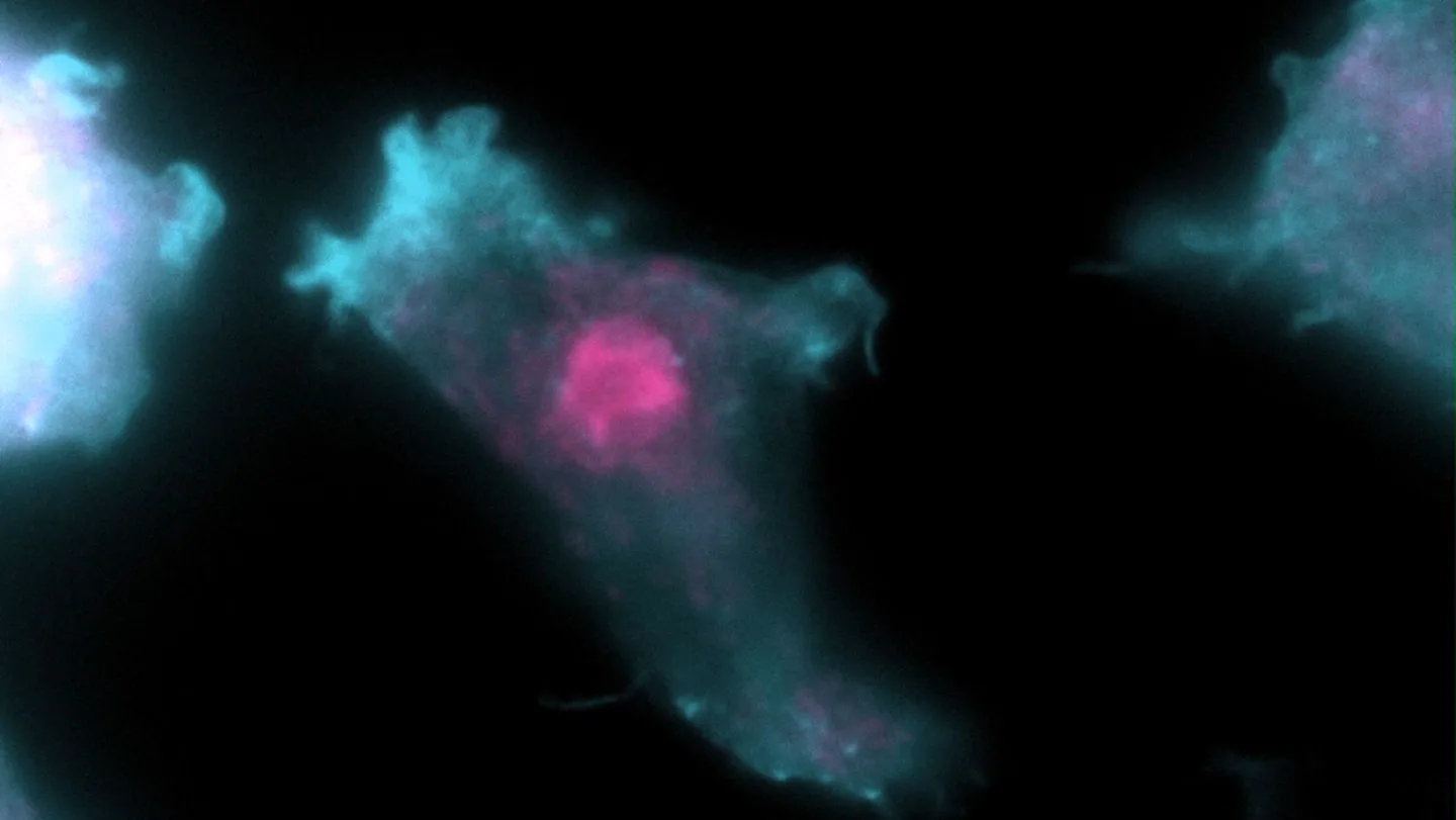 Here’s how brain-eating amoebas may infect people