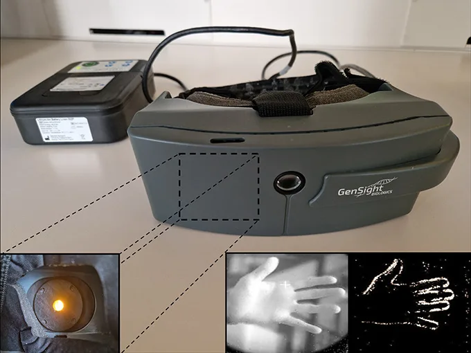 The googles and set-up that helps restore vision for a person who is blind 